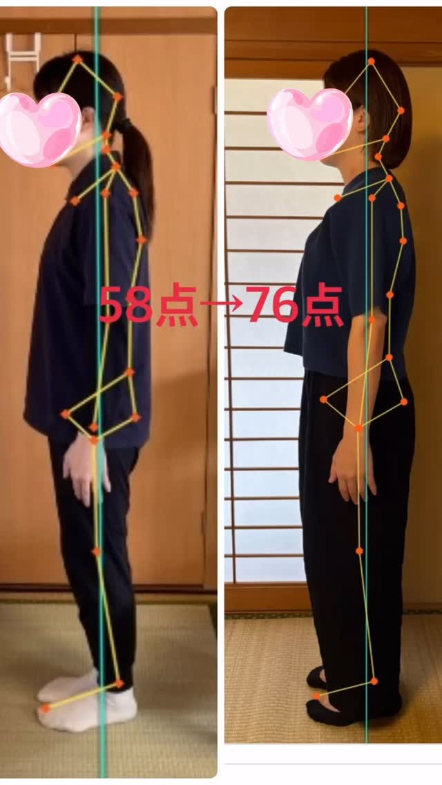 ✨30代の女性、1年半のあいだあいカイロプラクティックたけな...